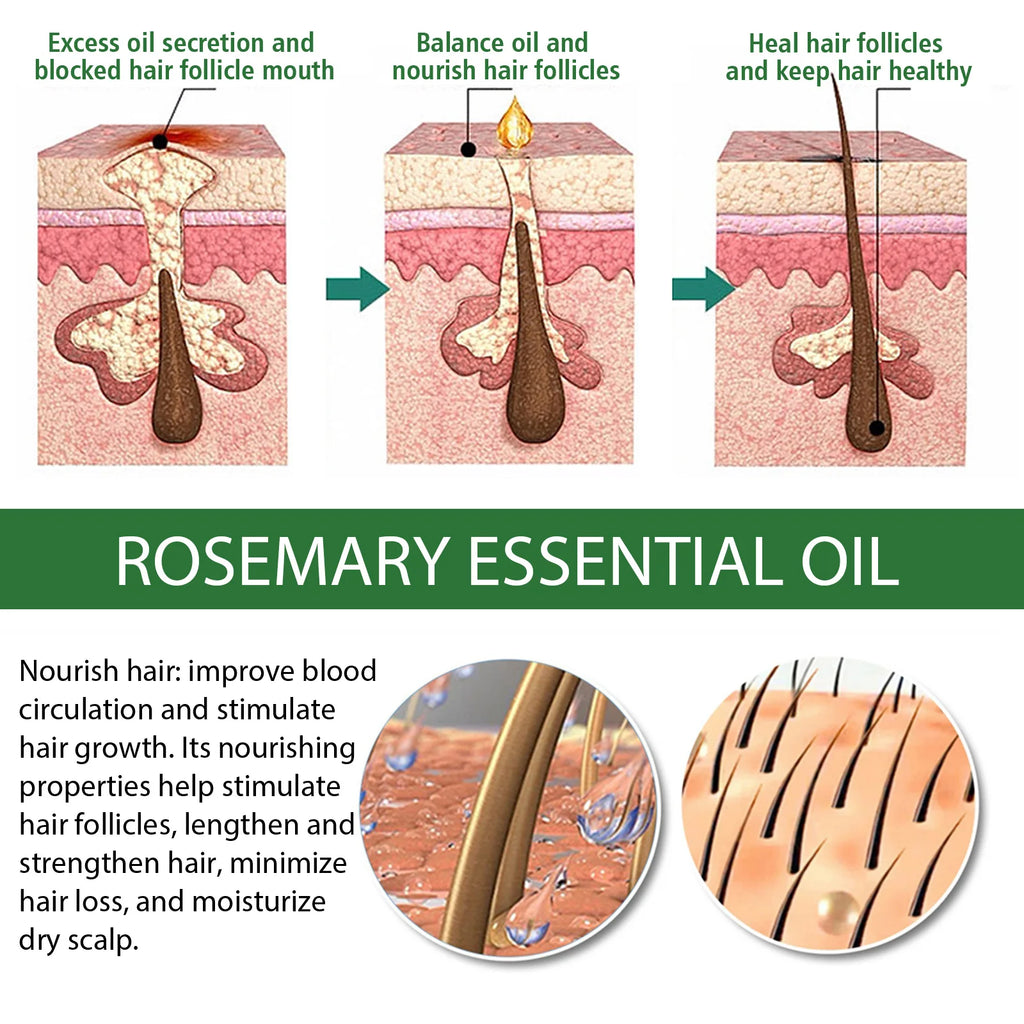 AYSUING Rosemary Essential Oil